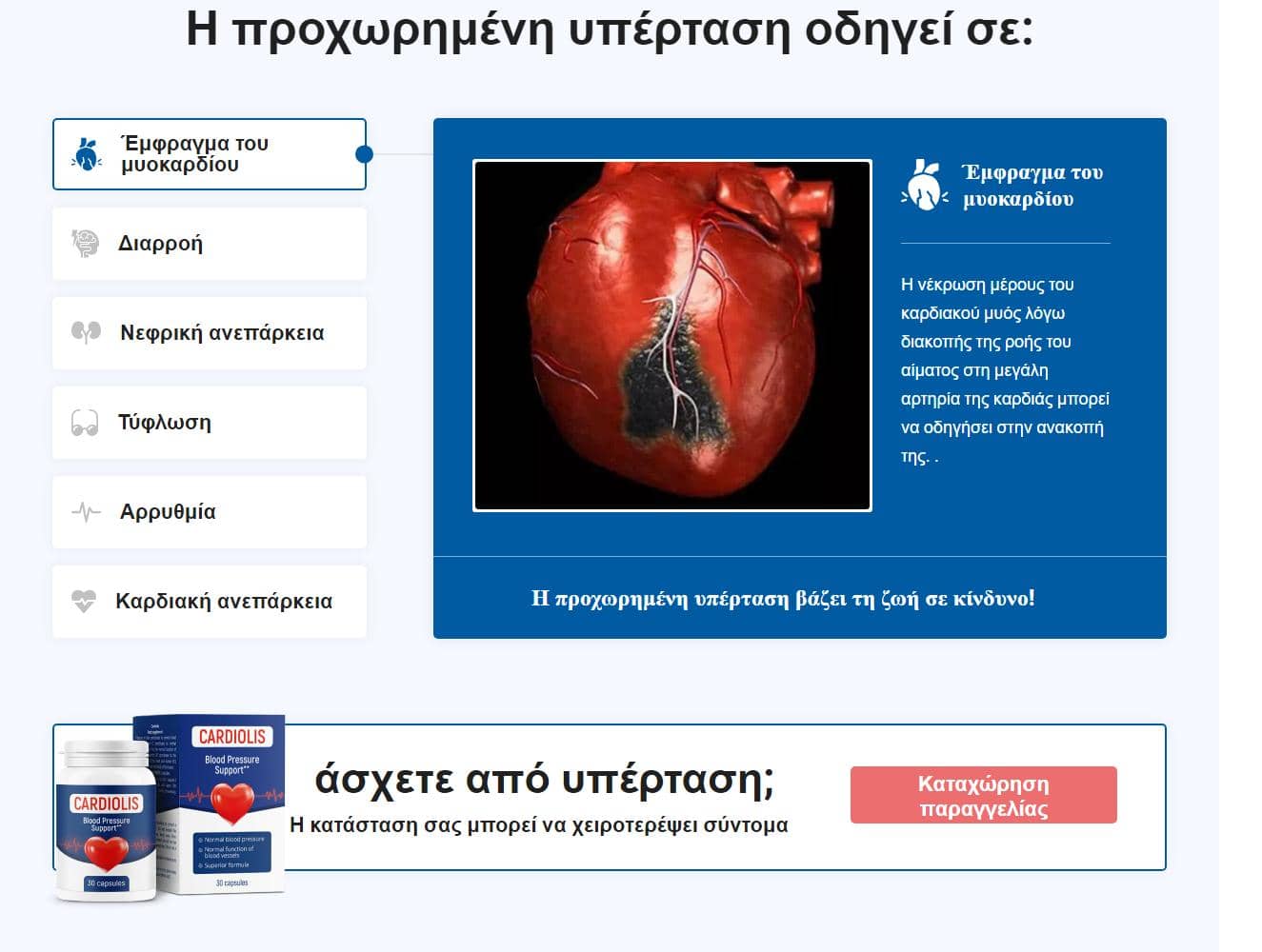 Cardiolis 3