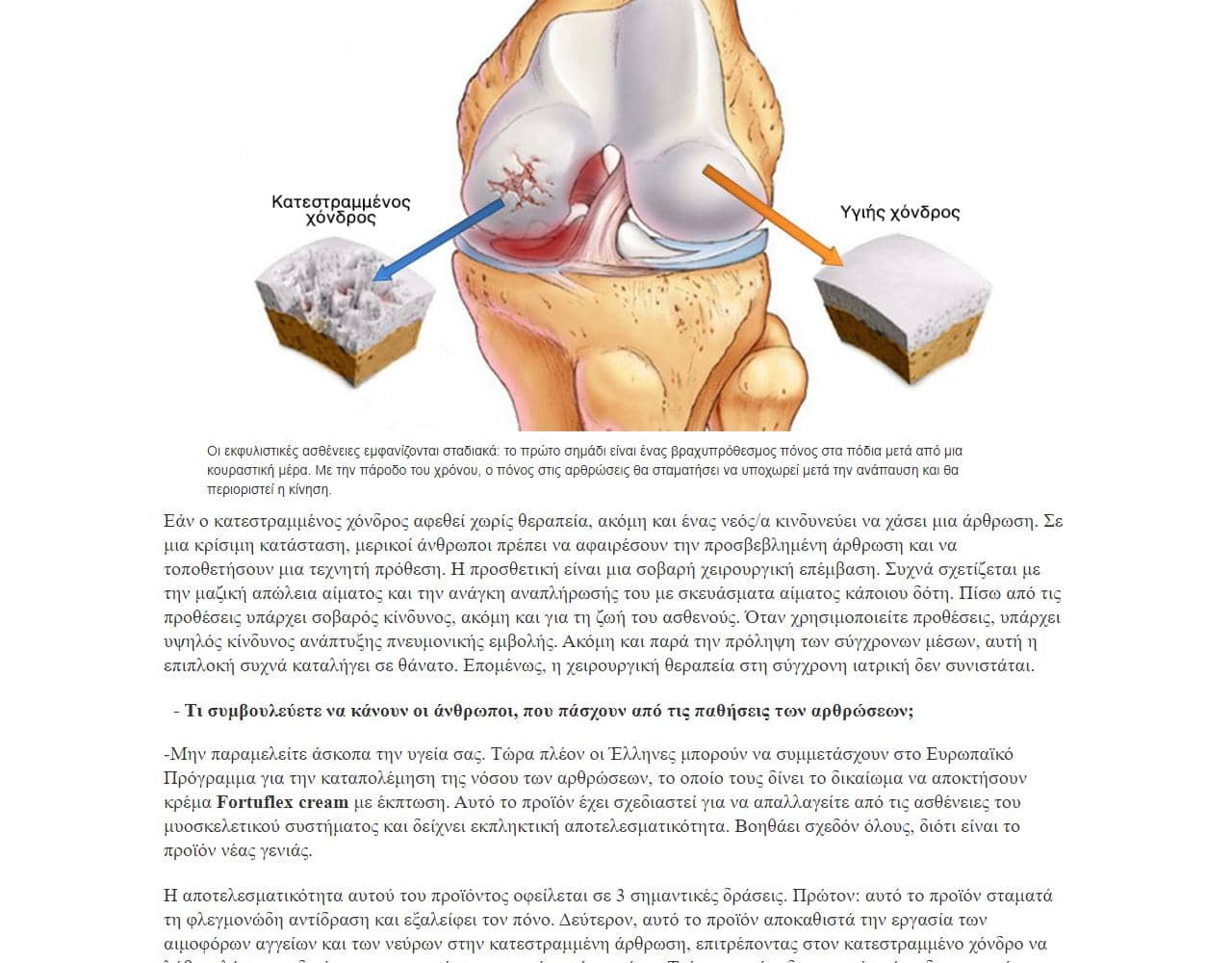 Fortuflex cream 3