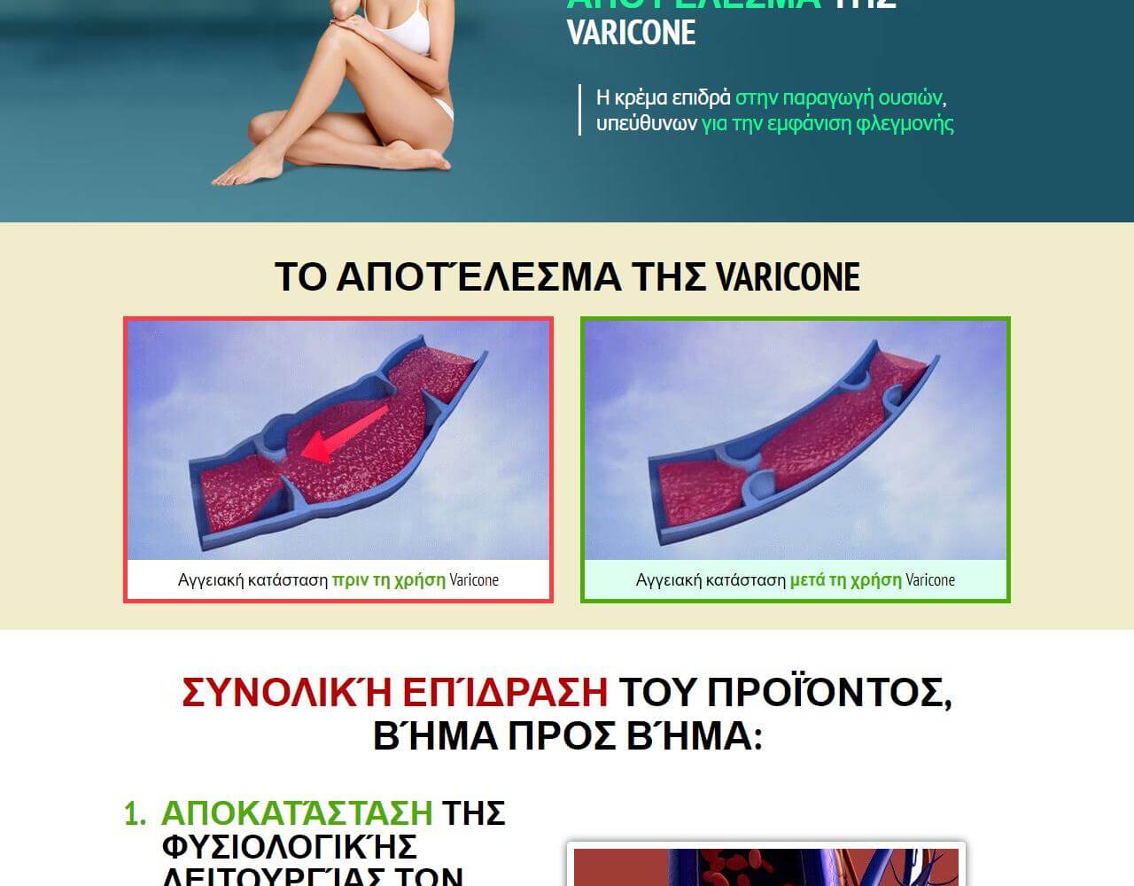 Varicone 5